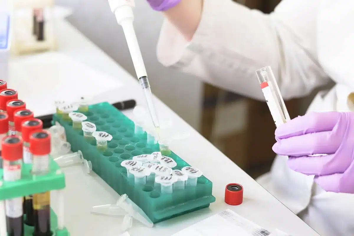 Microscope and petri dish in a bright laboratory, representing bacterial research